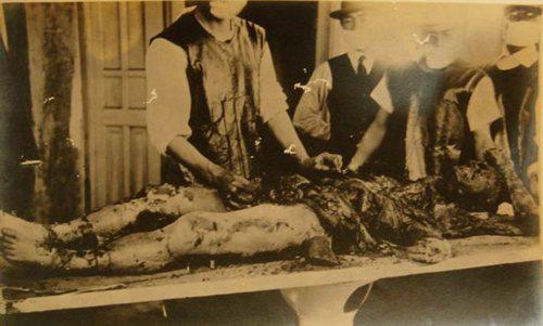 揭露日军731部队罪行的最新照片曝光：曾活体解剖婴儿